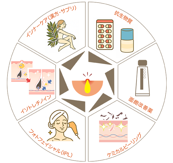 ニキビの治療