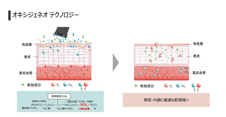 オキシジェネオ テクノロジー