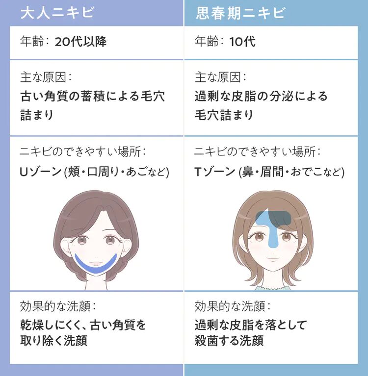 【画像】大人ニキビ、思春期ニキビの比較