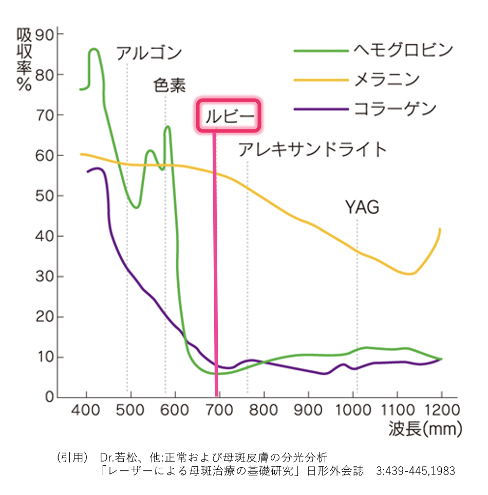 ルビーグラフ