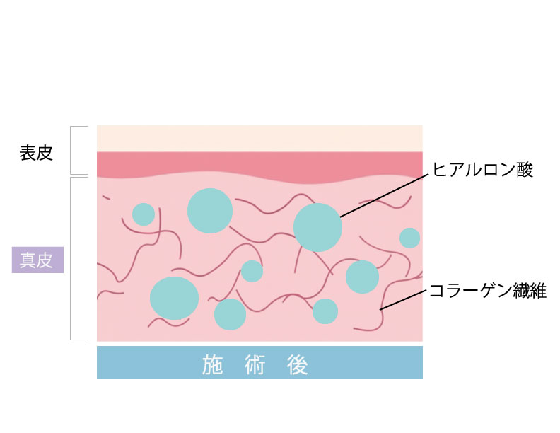 施術後
