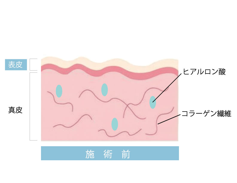 施術前